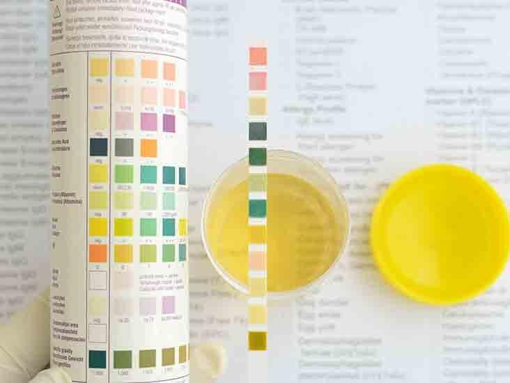 Electrolytes in Urine (24 Hrs)